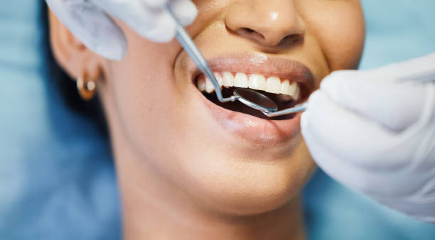 Best Dental Fillings (Composite and Amalgam)  in Chatsworth, IL